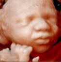 Blooming Baby Ultrasound
