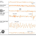 Neurodiagnostics